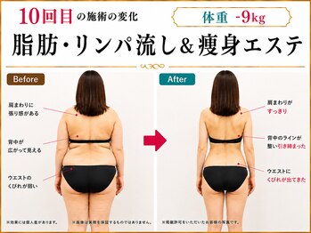 美宝 鈴蘭台の写真/結果重視のオーダーメイド痩身Wコース【セル脂肪燃焼×自律神経ケア】整えるほど、痩せる32年◇鈴蘭台３分
