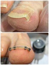 ウェルネスマルカ(wellness MARCA)/矯正