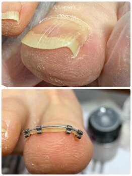 ウェルネスマルカ(wellness MARCA)/矯正