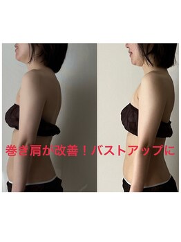 サントーシャ(Santosha)/巻き肩解消でバストアップにも