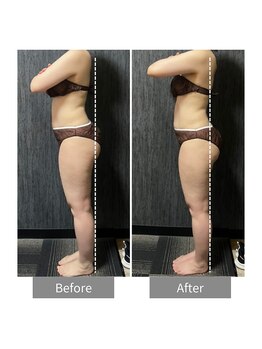 ヒヨリ(hiyori)/《before/after》body