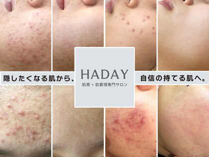 ハダイ(HADAY)の写真