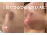 つるつる肌に【韓国式毛穴洗浄&ピーリング】+ドライヘッドスパ20分