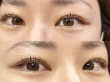 チッパー(CHIPPEr)/