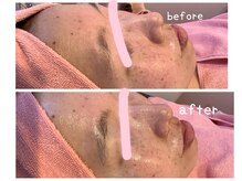 ヒメミ(Himemi)/艶肌Ｗａｘ