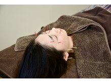 ビューティーパンク 黒田鍼治療院(Beauty Punc)/7.ここでひとまず休憩