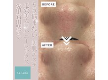 ラルーナ(LA LUNA)の雰囲気（結果の出る実力派フェイシャルメニュー多数、よもぎ蒸しと＋も可）