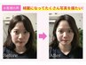 【6月3名限定】小顔矯正【たるみ改善・法令線・エラ・左右差】13,000円→