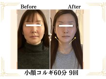 ベリール(BELIRE)/写真写り抜群の小顔コルギ！