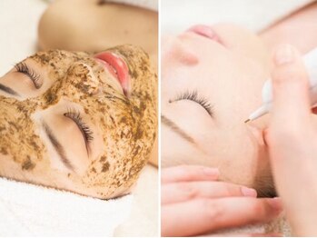 グレースフル 天文館店の写真/くすみ改善!肌トラブル予防にも◎【ハーブピーリング+10分間シミケア放題★¥7980】憧れの韓国女優肌に♪