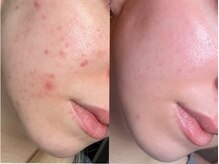 マリヴェリーテ(Mari verite)の雰囲気（丁寧なカウンセリング。お悩み、症状をお聞かせください。）