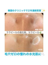 痩身・美肌管理専門店　private salon pixie【ピクシー】/韓国で2年連続受賞のセラピール