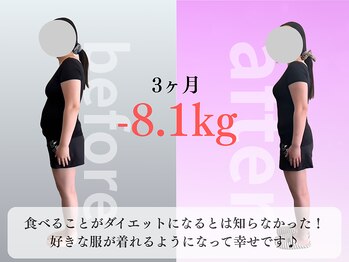 みくる整骨院 美容整体 清須/ダイエット/痩身/肩こり/整体