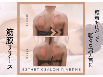 リヴェーヌ 富山店の写真/【熟練の筋膜リリースで10年以上の実績】首・肩こり解消には筋膜リリースが最適解！