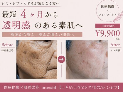 アルカンシエル(arcenciel)の写真