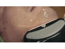 ニコル 春日井店(NICOL)/施術☆照射時間は短く◎