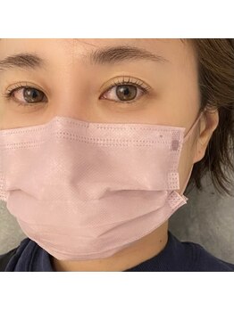 スー(Suu.)/ダメージレスカール