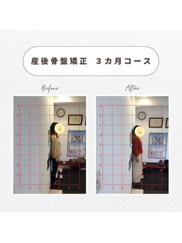 心斎橋長堀フェムテック整骨院の写真/【産後骨盤矯正60分¥4280】産後の体型復活やダイエットに◎お子様連れ大歓迎★体のお悩み何でも相談下さい!