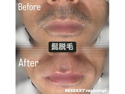 リゼクシー INTERNATIONAL麻布十番 六本木(RESEXXY)の写真