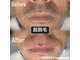 リゼクシー INTERNATIONAL麻布十番 六本木(RESEXXY)の写真