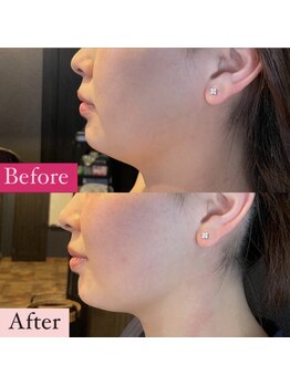 アディクト(Addict)/Before＆After