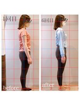 あんず美容整体サロン/◆姿勢症例◆