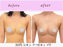 ビーハピネス 京都西院(B-Happiness)/20代　ボリュームアップ