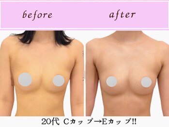 ビーハピネス 京都西院(B-Happiness)/20代 ボリュームアップ