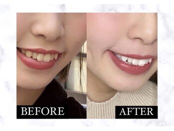 ライトケアサロン 銀座店(Light Care Salon)/銀座/新橋/有楽町好アクセス♪