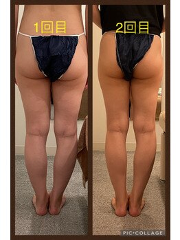 いおり骨盤整体 リブート(RE:BOOT)/セレクト痩身　下半身☆