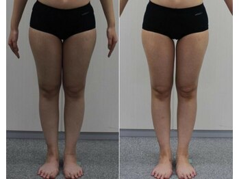 ファウンデーション(FOUNDATION)/ビフォーアフター