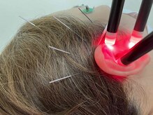 よしだ鍼灸整骨院 整体院/耳閉塞・雑音へのアプローチ