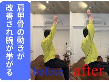 広島ミライエ整体院(広島MIRAIE整体院)/肩甲骨のつまり感がなくなる