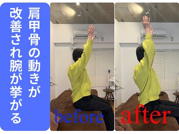 広島ミライエ整体院(広島MIRAIE整体院)/肩甲骨のつまり感がなくなる