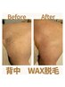 【背中ワックス脱毛】産毛ケア・角質ケアー・トーンUP+2000円☆潤いケア
