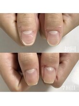 クレア(clea)/ネイルデザイン【浜松/ネイル】