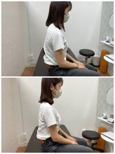 福岡西新整骨院/ビフォーアフター