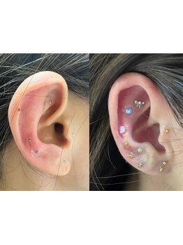 小顔になりたい