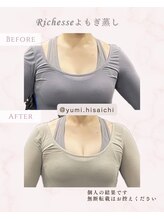 リリィ(RIRY)/【BODY ビフォーアフター】