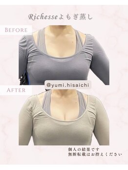 リリィ(RIRY)/【BODY ビフォーアフター】