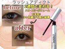 ルルバイアズール 草加店(LULU by azule)/花粉時期のおすすめまつ毛美容液