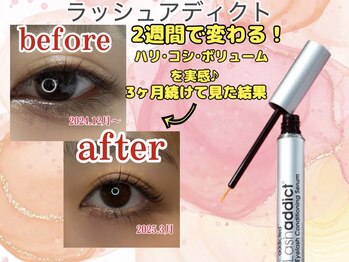 ルルバイアズール 草加店(LULU by azule)/花粉時期のおすすめまつ毛美容液