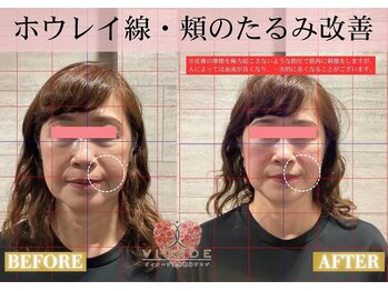ヴィオーデ美容整体サロン 川越店/小顔、リンパ、ヘッドスパ、整体