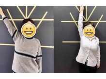 くまがい整体院 若松店/肩周りケアのお客様