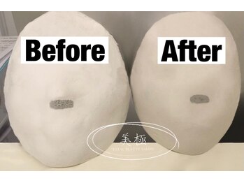 美極 トータルビューティー(美極 TOTAL BEAUTY)/恵比寿/小顔コルギ/エステ/