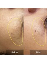 サロン ウイ(salon u'i)/～シミケア～