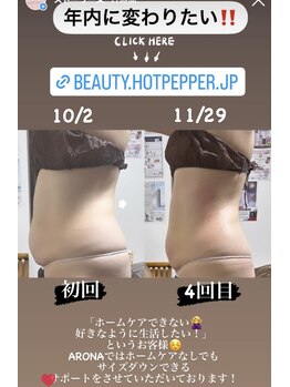 アローナ(ARONA)/新型ハイパーナイフで速効スリム