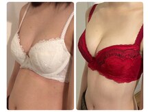 モナンジュ(ramonange)/バストアップ　before after