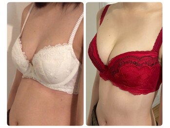 モナンジュ(ramonange)/バストアップ　before after