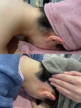 パリスヒロトン(PARIS HIROTON)/美肌脱毛【エステレベル最上級】